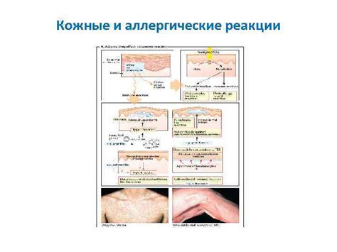 Аллергические реакции и другие кожные проблемы, вызывающие сыпь при нормальной температуре