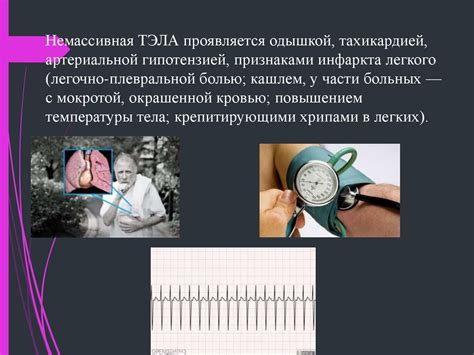 Альтернативные варианты: сочетание ухода и платной помощи