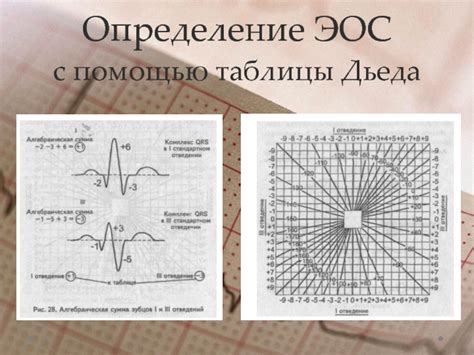 Анализ ЭОС с помощью геометрической фигуры Эйнтховена: передача информации о состоянии сердца с использованием зарегистрированных электрических сигналов
