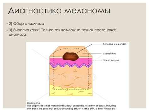 Биопсия хрящевой ткани: точная постановка диагноза
