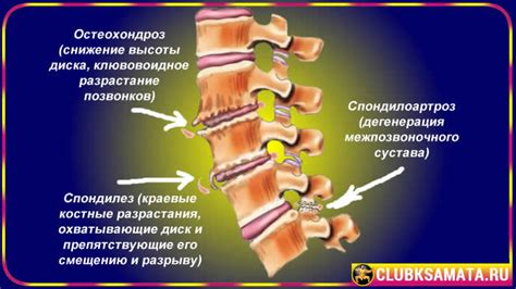 Важность выявления проблемы с шейным отделом позвоночника