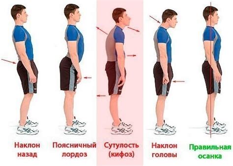 Важность поддержания правильной осанки