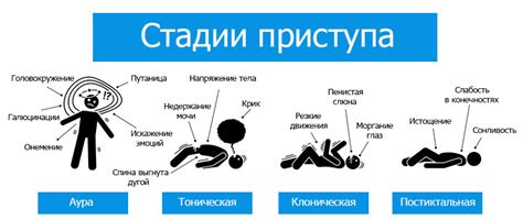 Вегетативные проявления эпилептического приступа: неприятные ощущения и нарушения здоровья