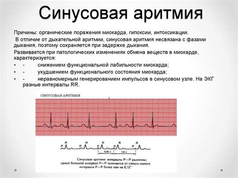 Взрослые и нерегулярный синусовый ритм