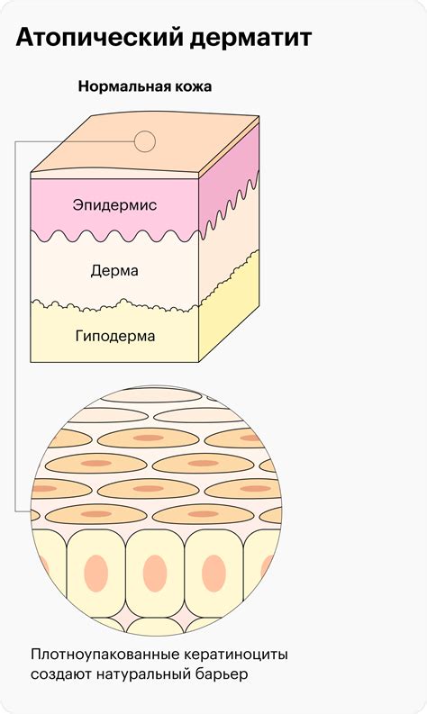 Влияние кристаллического дезодоранта на состояние кожи