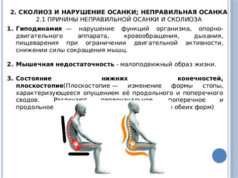 Влияние неправильной осанки на работе на состояние пресса и способы предупреждения