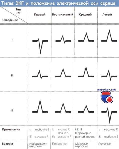 Влияние отклонения вектора электрической активности сердца на диагностику кардиальных недугов