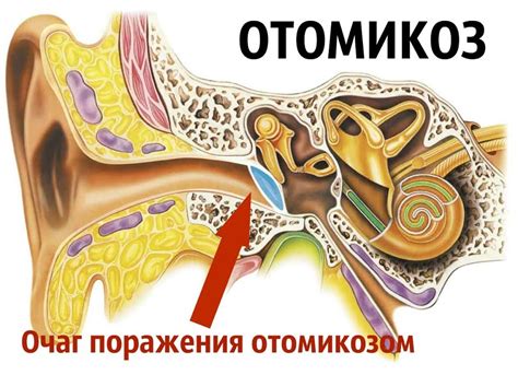 Влияние постоянного слышимого тиканья в ухе на наше здоровье