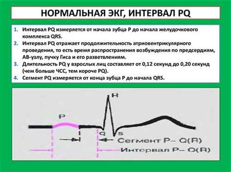 Влияние факторов на сокращение интервала pq на ЭКГ