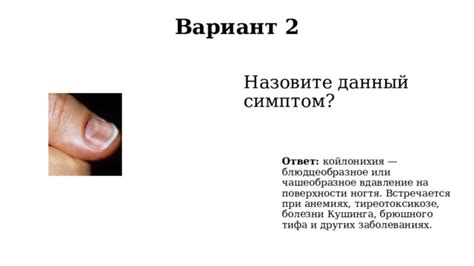 Внешние факторы, способствующие возникновению белых отметин на поверхности ногтя