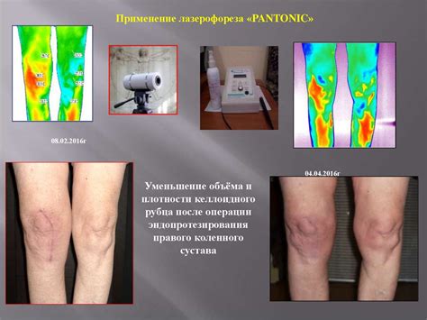 Возможности физиотерапии в восстановлении функциональности глаз
