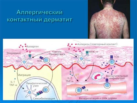 Возможные аллергические реакции и противопоказания