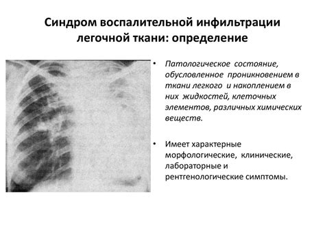 Возможные причины уплотнений в тканях легочной системы