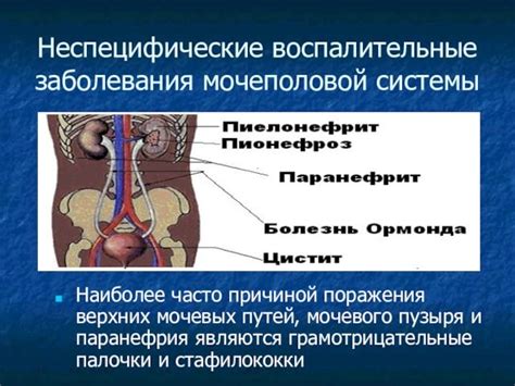 Воспалительные заболевания мочевых путей