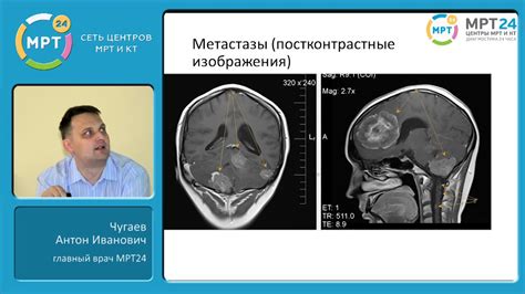 Диагностика кистозной образования в кавернозной области головы у взрослых: методы исследования