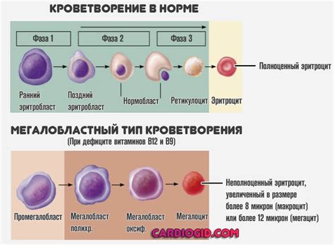 Диагностика микроцитоза