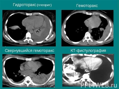 Диагностика осложнений при сгибе желчного органа