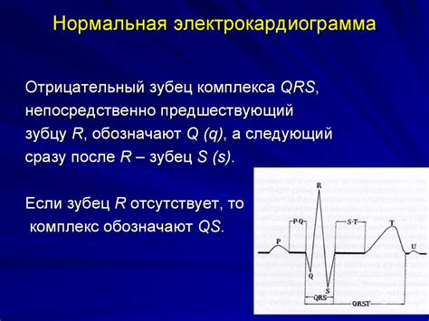 Диагностические методы при определении отсутствия зубца Р на ЭКГ