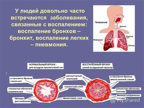 Заболевания дыхательной системы