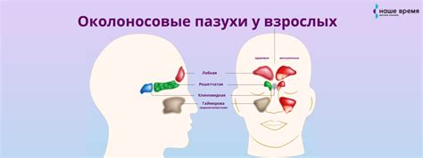 Застойная синусит: причины и методы разрешения проблемы