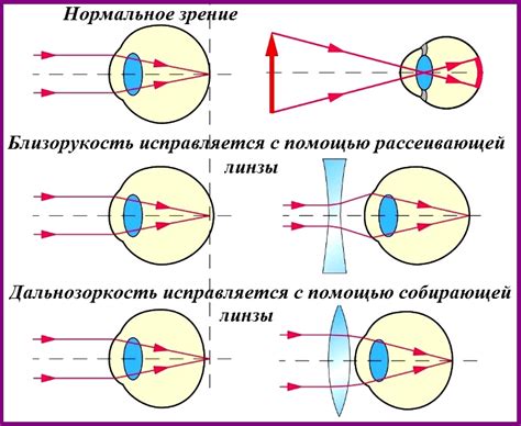 Зачем нужны функциональные наборы оптики (ФНО) и как они помогают?