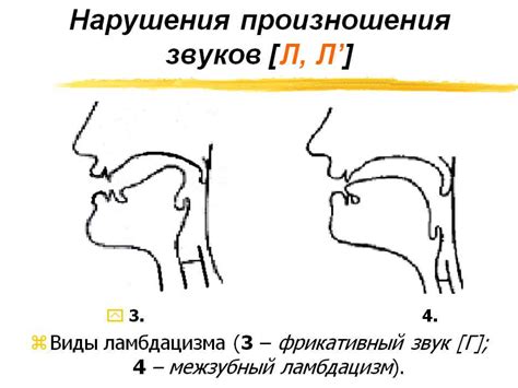 Значение корректной артикуляции звука "л"