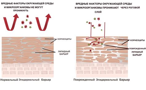 Избегание наделяющих кожу веществ и одежды