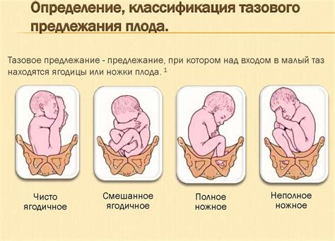 Изменение положения ребенка в матке