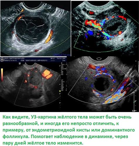 Имплантация и формирование желтого тела на месте фолликула