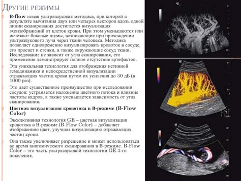 Исследование процесса визуализации одной из труб в теле человека