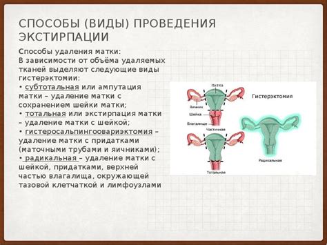 Каковы преимущества нервосберегающей экстирпации перед другими методами удаления матки?