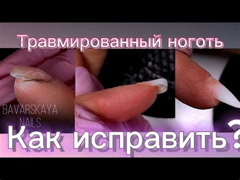 Как исправить половину поврежденного ногтя: 5 легких подсказок