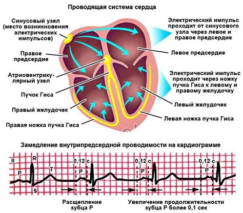 Как распознать нарушение проводимости по ПНПГ по симптомам