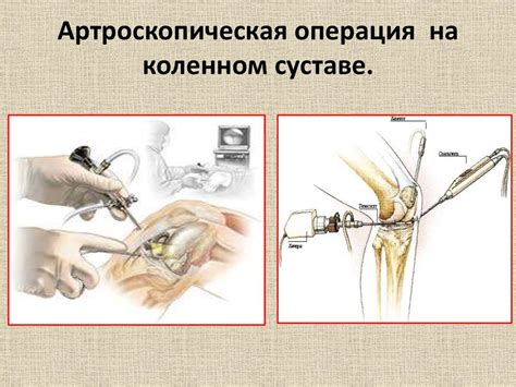 Консервативные методы лечения отсутствия хряща в коленном суставе: