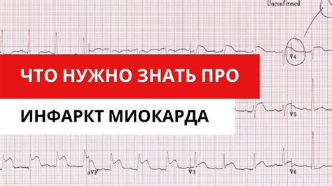 Критерии диагностики изменений структуры левого сердечного камерного миокарда при оценке данных ЭКГ