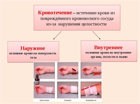 Кровотечение из-за сниженной свертываемости крови