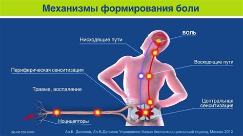 Кто подвержен риску развития боли в пояснице