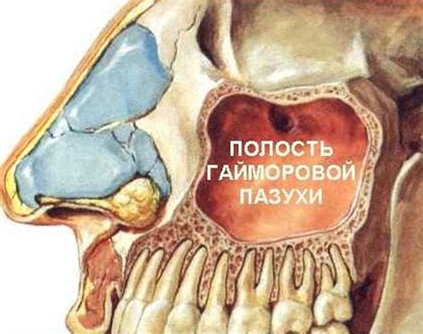 Лечение гайморита и восстановление обоняния