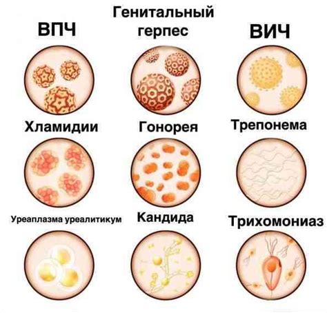 Лечение и профилактика проблем с мочеотделением у женского организма