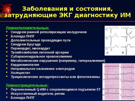 Лечение неспецифических нарушений реполяризации на ЭКГ