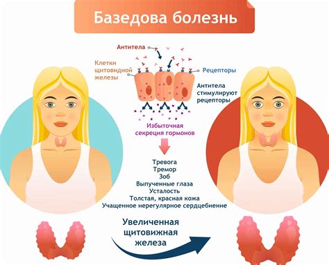 Лечение нетоксичного одноузлового зоба