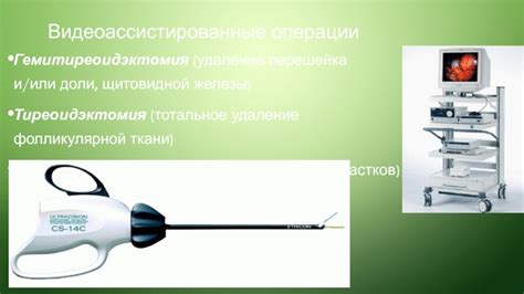 Манипуляции и удаление пораженных тканей в ходе операции: процесс выполнения