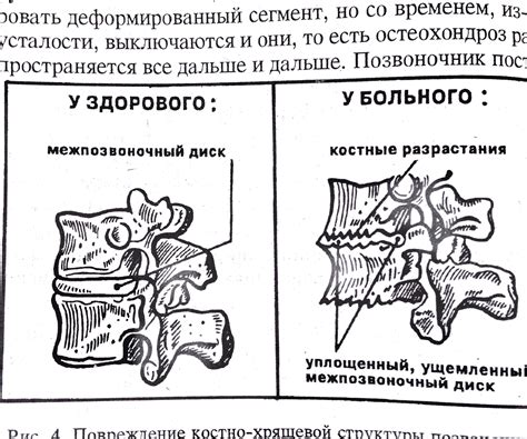 Методы выдержки