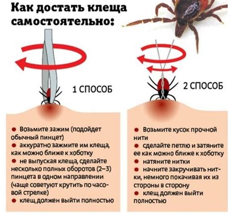 Методы извлечения клеща с применением специализированных приспособлений