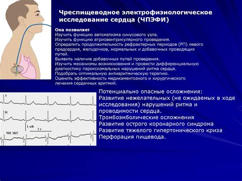 Методы лечения нерегулярного ритма сердца