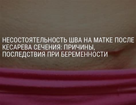 Методы лечения несостоятельности рубца на матке