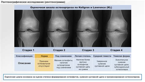 Нарушения в работе суставов