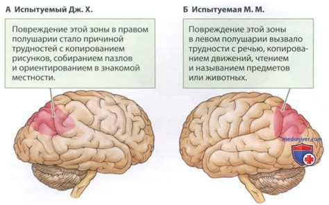 Нейрологическое объяснение возникновения ощущения повторности