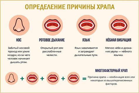 Непрямые признаки, свидетельствующие о гомосексуальности