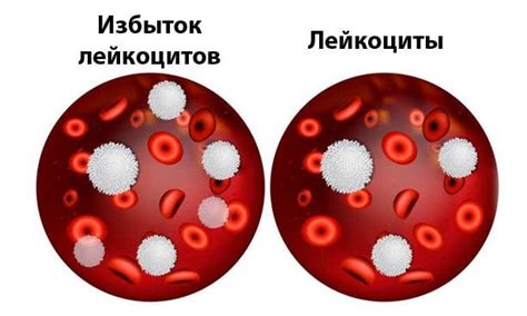 Неспецифического генеза: что это